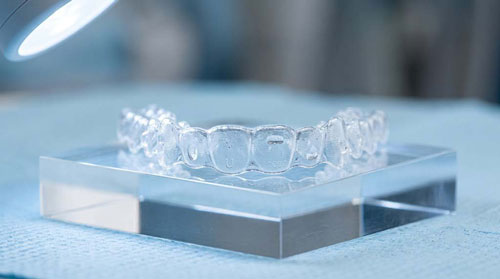 CTARS Aligner [hình ảnh cần xác nhận]