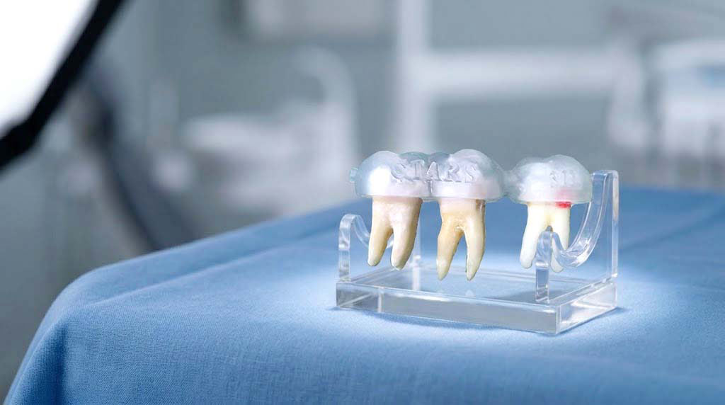 CTARS 3D Endodontics — Endodontic Guides
