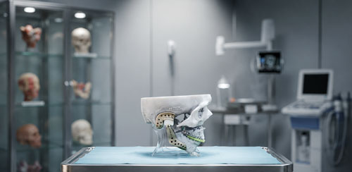 CTARS TJR — Total Joint Replacement