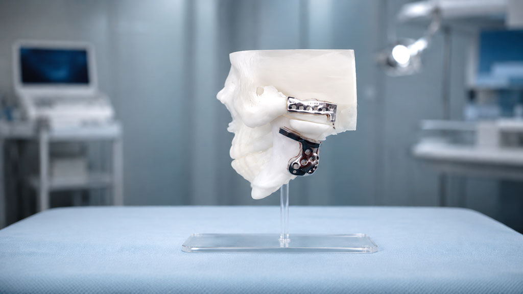 CTARS cutting guide resection