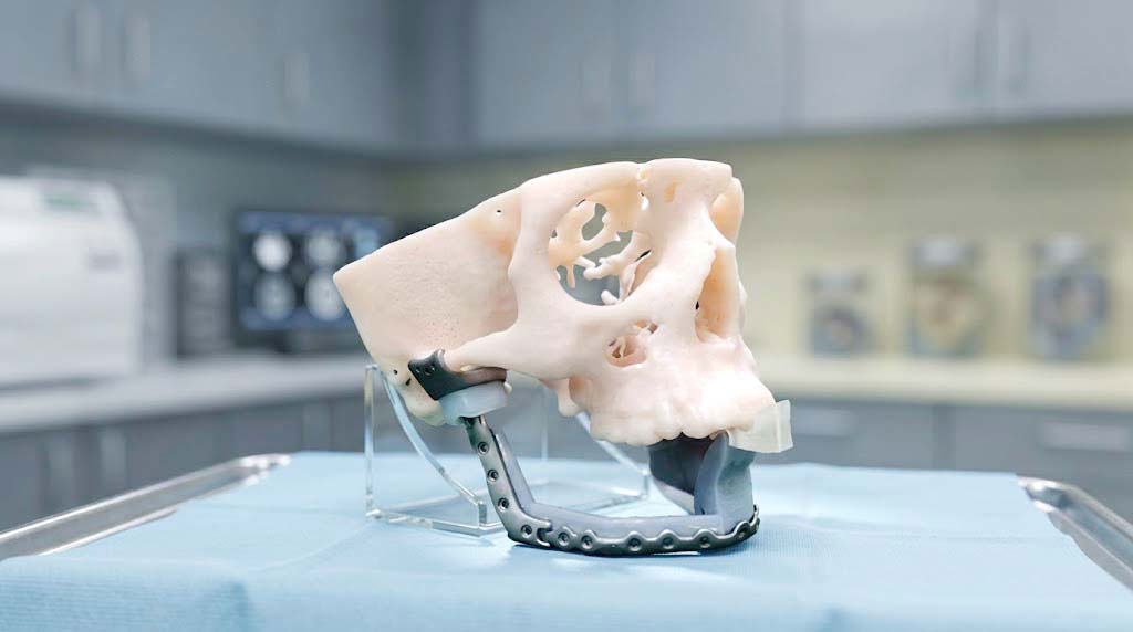 CTARS TJR custom joint components